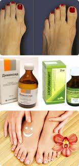 можно ли избавиться от косточки на ноге без операции Kak Samostoyatelno Izbavitsya Ot Kostochki Na Noge Organic Nutrition Health And Beauty Health Fitness