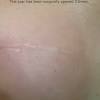 Genetic defects found on brca1 and brca 2 can dramatically increase. 1