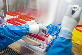 Lako pojavljivanje modrica, česta krvarenja iz nosa i desni, obilne menstruacije i duga krvarenja posle porođaja čak i posle manjih posekotina simptomi su mogućeg poremećaja zgrušavanja krvi kod žena. Modrice Posle VaÄ'enja Krvi Nisu Retkost Laborantkinja Otkriva Da Li Su Opasne I Kako Da Ih Saniramo Telegraf Rs