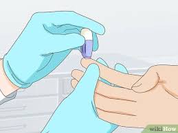 Can you really be allergic to alcohol? 3 Ways To Tell If You Have Allergies To Liquor Wikihow