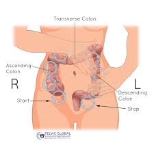 Image result for Pelvic Floor Dysfunction