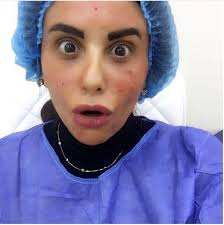 الألوان الزاهية ، لا سيما الأحمر والبرتقالي ، تجذب انتباه الزائرين. Ø¯Ø§Ù†Ø§ Ø­Ù…Ø¯Ø§Ù† ØªØ®Ø¶Ø¹ Ù„Ø­Ù‚Ù† Ø§Ù„ØªØ¬Ù…ÙŠÙ„ ØµÙˆØ± ÙˆÙÙŠØ¯ÙŠÙˆ