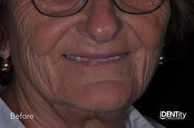 Less Is More: Building Functional Esthetics