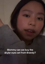 Brandy Billy Eye Update