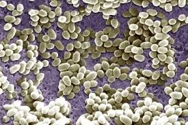 Box 6100, mississippi state, mi 39762, usa. Listeria Ivanovii Alchetron The Free Social Encyclopedia