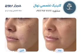 10 بهترین دکتر جوانسازی پوست در شیراز + 7 درمان جوان سازی