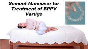 Image result for Canalith Repositioning Procedure