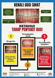 Maybe you would like to learn more about one of these? Dr Afiq Rahim Dar On Twitter Tahukah Anda Merokok Kencing Manis Stress Antara Punca Penyebab Masalah Gusi Kita Dan Berus Gigi Dua Kali Sehari Serta Kurangkan Pengambilan Makanan