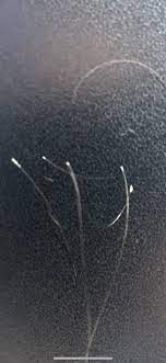 White bulbs at the end of hairs that have fallen belong to this phase. Shedding Hair With White Bulbs At End Hairlosstalk Forums