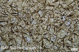 Image result for steel micrograph