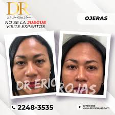 Dr. Eric Rojas Blanco