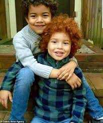 Red hair (or ginger hair) occurs naturally in one to two percent of the human population, appearing with greater frequency (two to six percent). Mother Says People Accuse Her Of Kidnapping Her Own Son Seven Because He Has Bright Red Hair Express Digest