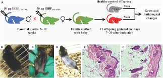 Uveitis refers generally to a range of conditions that cause inflammation of the middle layer of the an injury to the eye, a viral or bacterial infection, and some underlying diseases may cause uveitis. Frontiers Parental Uveitis Influences Offspring With An Increased Susceptibility To The Experimental Autoimmune Uveitis Immunology