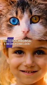 ✨ Fascinating Facts About Eyes! ✨, 👁‍🗨 Heterochromia: A Mesmerizing Look!  👁‍🗨, Heterochromia is a true gift of nature! Only 1% of the world's  population has this rare eye condition, making it a unique ...