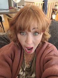 We had some people at the support group with fistula issues. Here's the  link for a support group for them, as well.  [](https://fistulafoundation.org/) Fistula Foundation  https://fistulafoundation.org