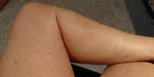 Spray Tanning Mature Skin Invisible Spots That Appear From Nowhere Tampa Bay Tan