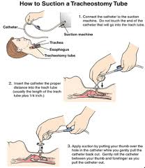 Trach Care Nursing Care Tracheostomy Care Nursing School Survival