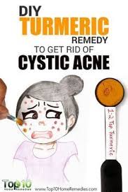 Home Remedies For Cystic Acne Top 10 Home Remedies Back Acne Treatment Cystic Acne Cystic Acne Remedies