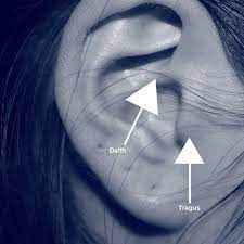 Tragus And Daith Ear Piercings For Migraines With Reviews Migraine Piercing Tragus Piercing For Migraines Ear Piercing For Migraines