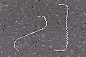 Maybe you would like to learn more about one of these? Leptospirosis In Dogs Veterinary Partner Vin