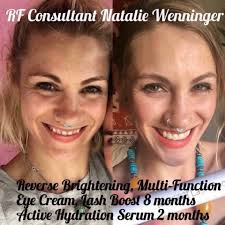 Natural skincare alternatives to RF treatments