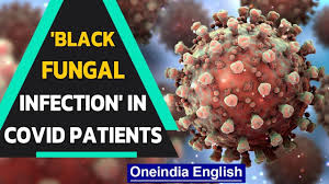 Delhi: Sir Ganga Ram Hospital sees the rise of black fungal infection in  Covid-19 patients | - YouTube