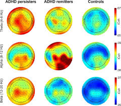 If you are concerned about whether a child might have adhd, the first step is to talk with a healthcare provider to find out if the symptoms fit the diagnosis. Atypical Functional Connectivity In Adolescents And Adults With Persistent And Remitted Adhd During A Cognitive Control Task Translational Psychiatry