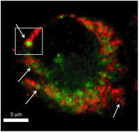 They are pleomorphic they are mostly globular or granular in appearance. Chemical Probe Profiles Live Cell Organelle Activity Adds To Understanding Of Lysosome Dynamics