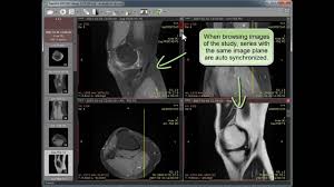 Osirix is a dicom viewer for mac os. Radiant Dicom Viewer For Mac Free Download Horos Dicom Viewer