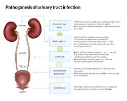 Ceufast Com Pathogenesis Of Urinary Tract Infection