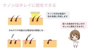 ケノンの脱毛原理 ケノン 脱毛 脱毛器