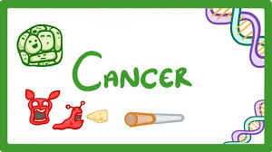 Cancer is the second leading cause of death in the developed world, and yet we are still in the dark ages when it comes to treating and understanding it. Gcse Biology What Is Cancer Benign And Malignant Tumours Explained 23 Youtube