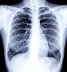In 2018, the bureau of labor statistics (bls) projected the number of available radiologic. X Rays Guide Drugs Com