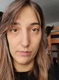 Ich nenne meine Leber Mila, spanisch für Wunder.“