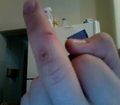 I Can T Believe I Cut Myself On The Same Finger Again Ign Boards
