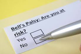 signs and symptoms of bells palsy mayo clinic news network