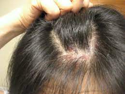Pin On How To Take Care Of Your Hair