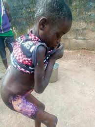 This will ensure that the drug will work as it should. Lady Pours Hot Water On 8 Year Old Househelp For Licking Milk In Anambra Graphic Photos Insidenaija