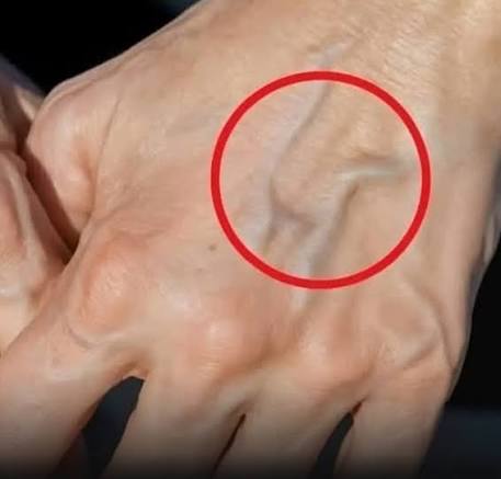 Why your veins look more prominent: body signals you should understand