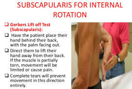 Image result for Lift-Off Subscapularis Test