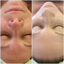 Now choose the nano module and apply bb glow pigment serum. Bb Glow Beautytouch Studio Wolfsburg