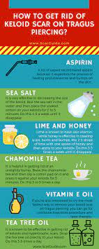 How To Get Rid Of Keloid Scar On Tragus Piercing Visit Us At Http Www Scarguide Com How To Get Rid Of Keloid Scar On Tareas De Ninos Infografia Actividades