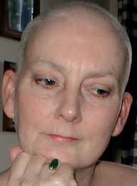 Do you find it difficult to keep your fingers off your itchy scalp? A New Baldness Cure Smell Receptors In The Human Scalp Psychology Today
