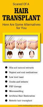 Scared Of A Hair Transplant Here Are Some Alternatives For You Hair Transplant Transplant Hair Loss