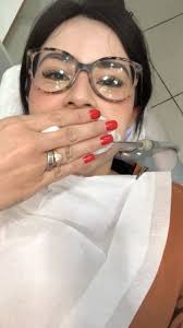 Já tinha usado na minha adolescência por 2x o aparelho convencional e  fiquei por muitos anos com ele e nunca tive um resultado satisfatório. Meus  dentes estavam entortando cada vez mais quando decidi ...