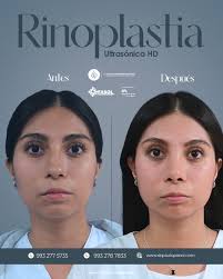 Dr. Paulo Pérez (@dr.paulo_otorrino) • Instagram photos and videos