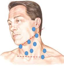 Lumps on the neck or behind ears are a rather common issue. Lumps Campaign General Surgery Singapore