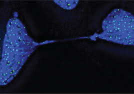 Liquids & solids lecture 2: Image Of The Day Sticky Telomeres The Scientist Magazine