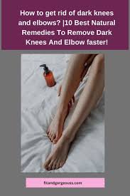 Skincare routine for dark elbows and knees How To Get Rid Of Dark Knees And Elbows 10 Best Natural Remedies To Remove Dark Knees And Elbow Faster Fit Gorgeous