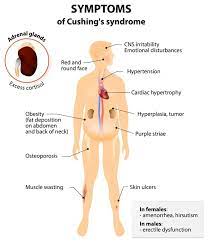 Sinais E Sintomas Da Sindrome De Cushing